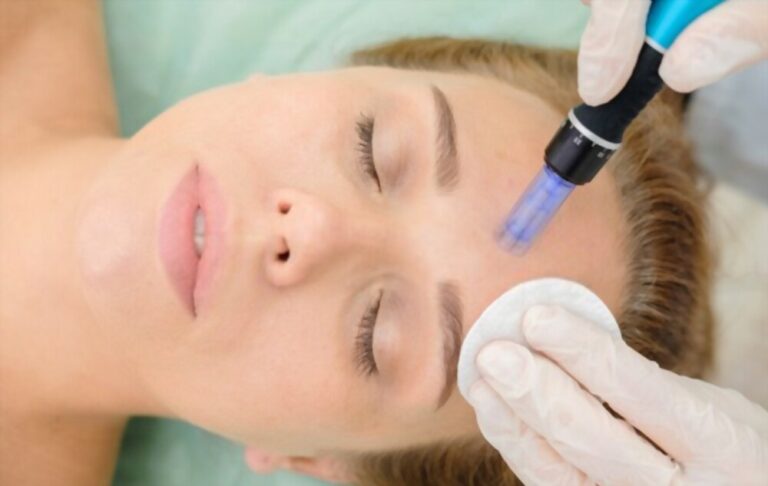 Unlocking the Power of Microneedling: How It Helps To Improve Skin Texture