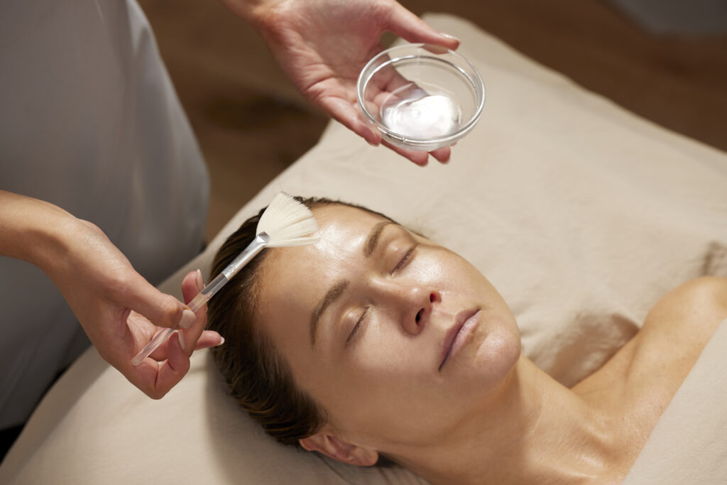 Chemical Peel-1-Treatment Image_vHiRes (1)